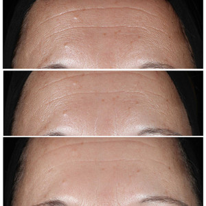 Smart Clinical Repair Serum - Faltenkorrektur-Serum Smart Clinical Repair Serum - Faltenkorrektur-Serum
